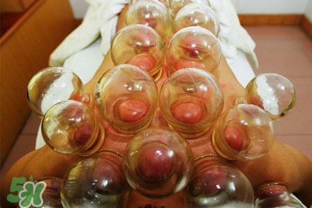 拔罐放血是用三菱针吗？拔罐放血用什么针？