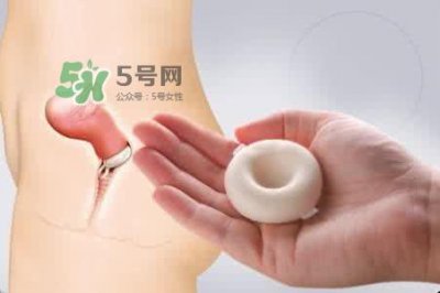 ​杀精剂有什么副作用？杀精剂的使用方法