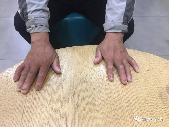 刘忠林故意杀人案改判无罪  个中细节引人深思