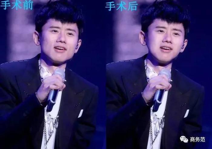 娱乐 | 为什么总有人说张杰“闰土”？