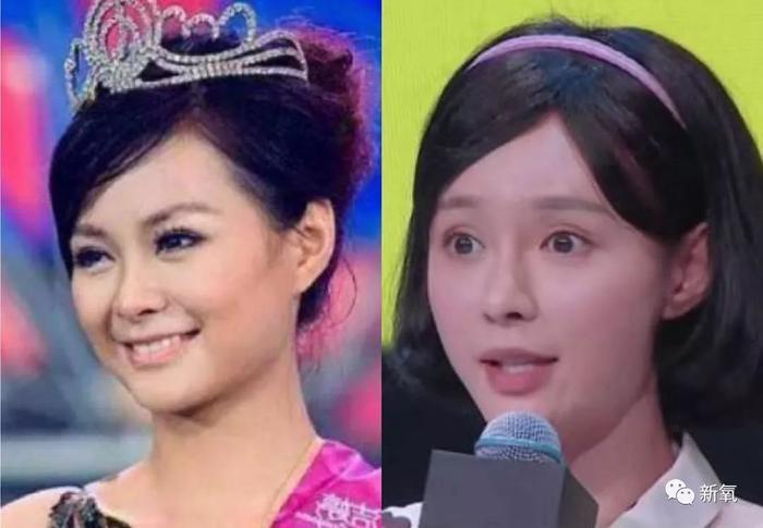 这哪里是《演员请就位》，简直就是《整形鉴别师请就位》！