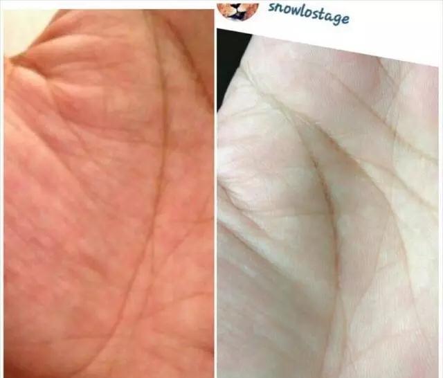 虐狗引起不适！周扬青即使整容也挡不住罗志祥爱得高调