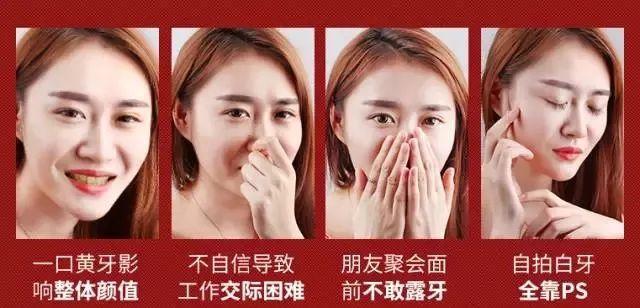牙齿再黄，有了这款黑科技纳米牙擦，轻轻一擦，牙渍全无！