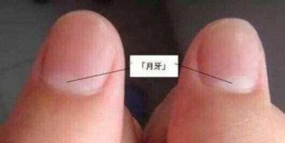 ​手指甲月牙白越来越少(指甲月牙越来越少怎么回事)