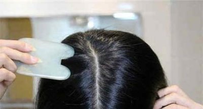 ​头屑痒怎么办(头发又痒又头皮屑怎么能好)