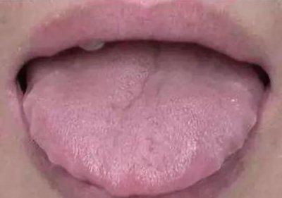 ​有湿气怎么去湿气(近十五天温度)