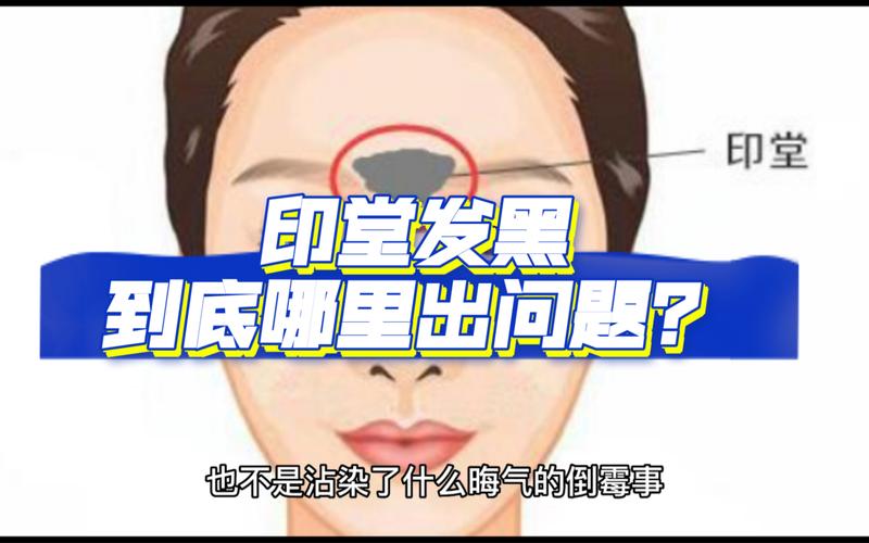 印堂怎么看发黑(印堂发黑不是玄学)