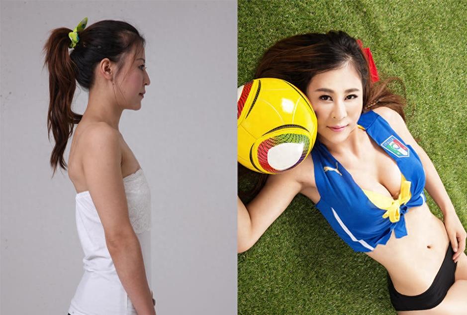 19名女子公布整容前后照片