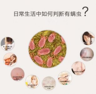​螨虫怎么去除最有效方法？螨虫怎么去除简单方法可以用白醋
