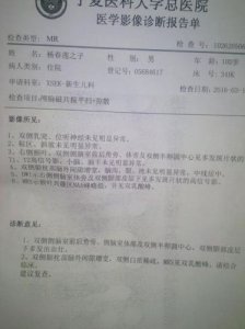 ​脑炎严重吗能治愈吗？脑炎是怎么引起的 脑炎严重吗