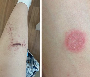 ​室内养猫对人的危害