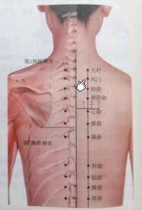 ​每日一穴——风门穴