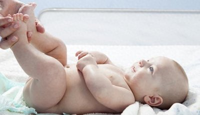 ​宝宝有没有腿纹不对称，你注意到了吗？