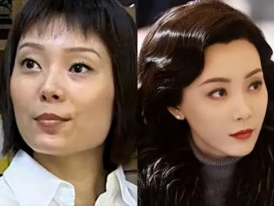 ​这几位女星的整容坎坷之路：长得“美若天仙”，整得“奇奇怪怪”