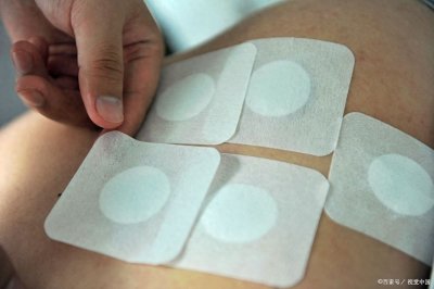 ​三伏贴时间到！中医详解三伏贴效果、贴伏时间、适合族群、禁忌症