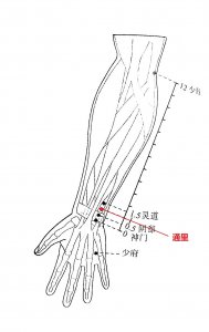 ​通里穴的妙用